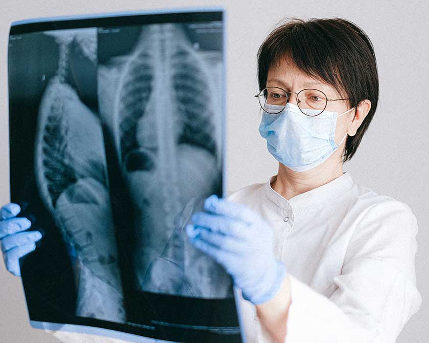 medical professional holding x-rays