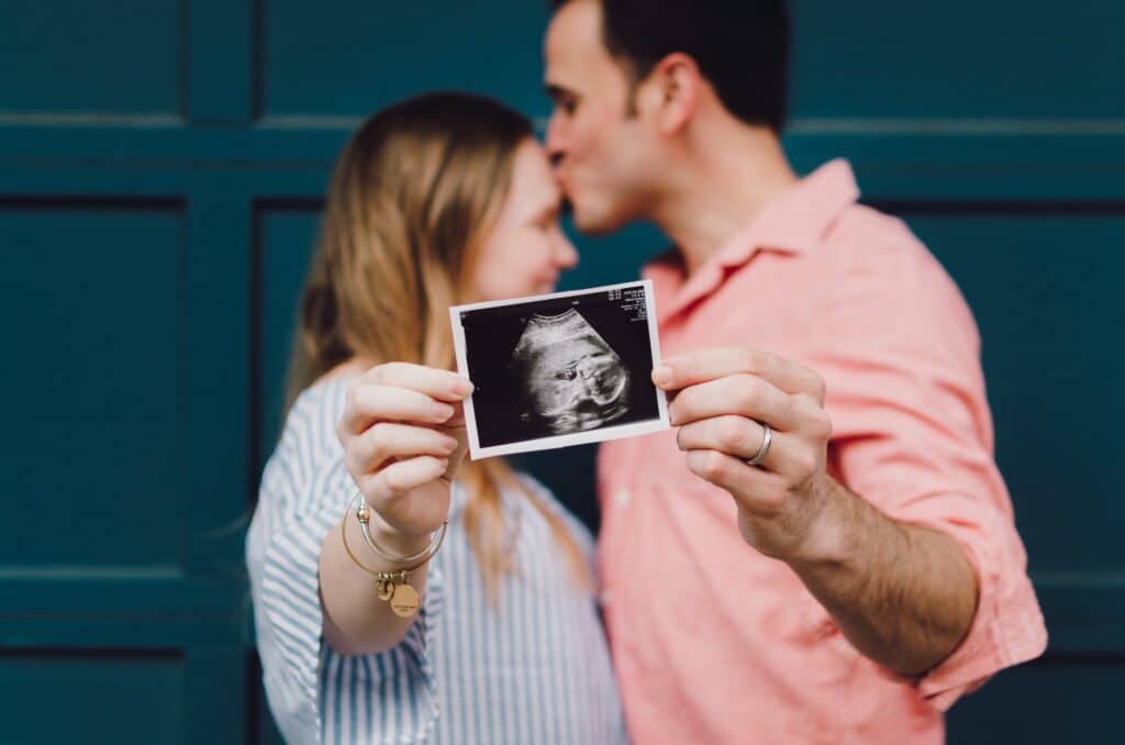 a man kissing a woman's forehead as they both hold a baby ultrasound